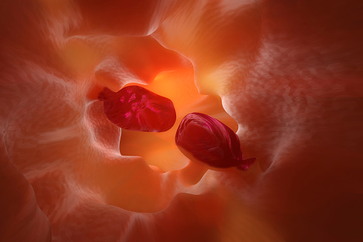 rectal cancer dostarlimab